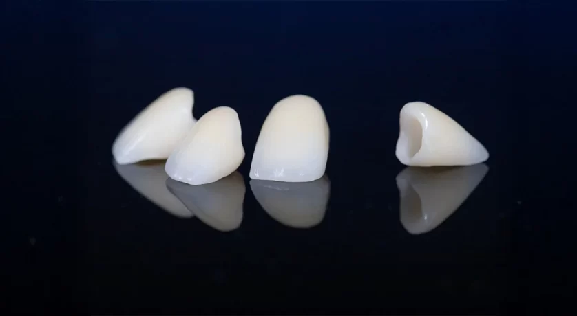 Does Getting a Dental Crown Hurt? What New Castle County Patients Should Expect
